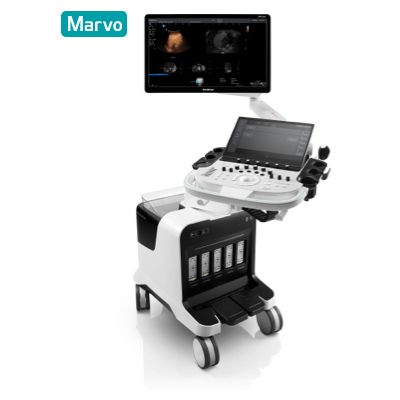 SonoScape Ultrasound System S80 Elite